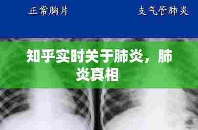 知乎实时关于肺炎,肺炎真相