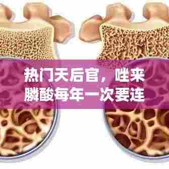 热门天后官，唑来膦酸每年一次要连续注射吗 