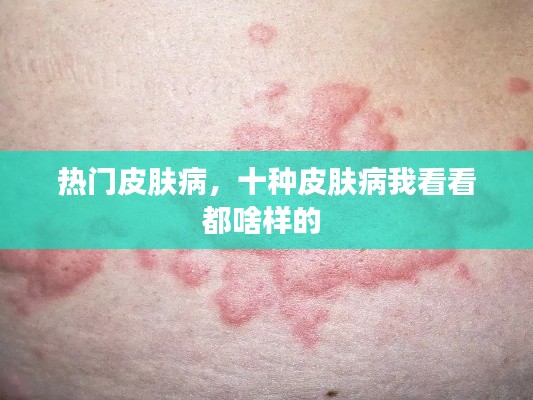 热门皮肤病,十种皮肤病我看看都啥样的