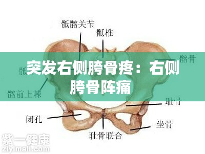 突发右侧胯骨疼:右侧胯骨阵痛
