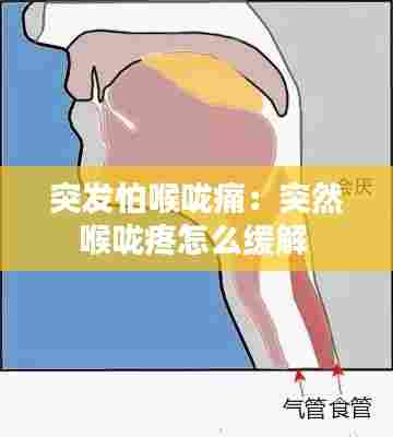 突发怕喉咙痛：突然喉咙疼怎么缓解 