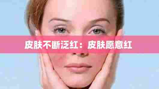 皮肤不断泛红：皮肤愿意红 