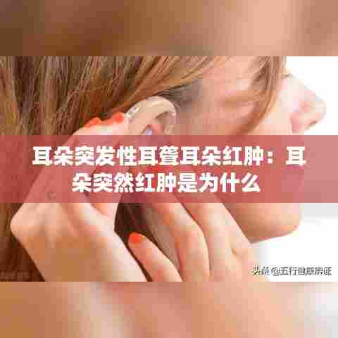耳朵突发性耳聋耳朵红肿：耳朵突然红肿是为什么 