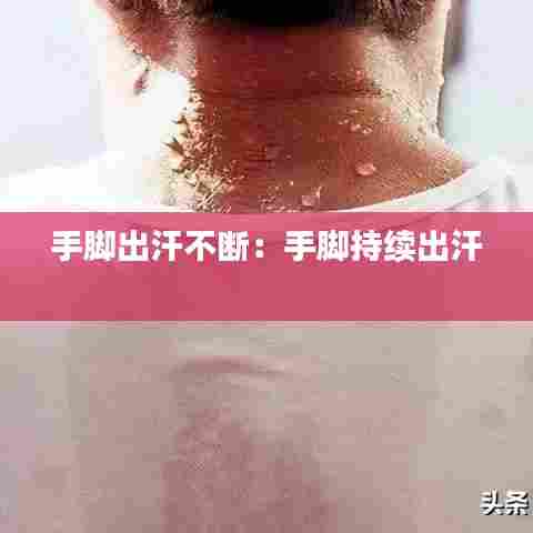 手脚出汗不断:手脚持续出汗