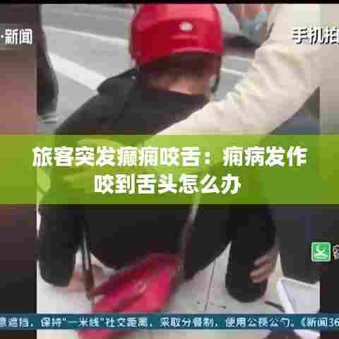 旅客突发癫痫咬舌：痫病发作咬到舌头怎么办 