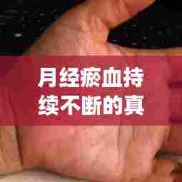 月经瘀血持续不断的真相，成因、影响及应对之策