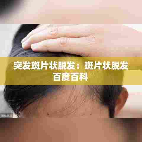 突发斑片状脱发：斑片状脱发百度百科 