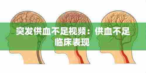 突发供血不足视频：供血不足临床表现 