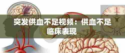 突发供血不足视频:供血不足临床表现