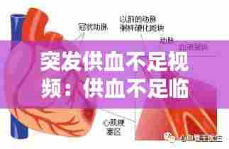 突发供血不足视频:供血不足临床表现