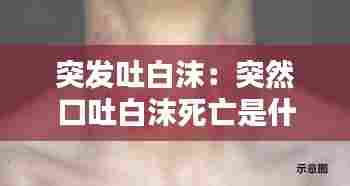突发吐白沫：突然口吐白沫死亡是什么原因? 