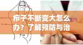 疖子不断变大怎么办?了解预防与治疗方法大解析