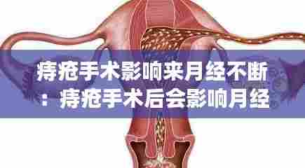痔疮手术影响来月经不断：痔疮手术后会影响月经推迟吗? 