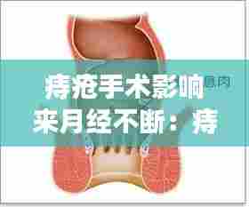 痔疮手术影响来月经不断:痔疮手术后会影响月经推迟吗?