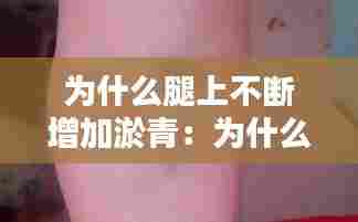 为什么腿上不断增加淤青：为什么腿上一直出现淤青 