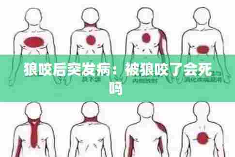狼咬后突发病:被狼咬了会死吗