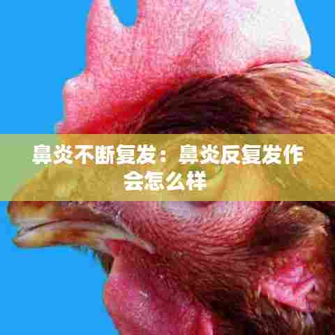 鼻炎不断复发:鼻炎反复发作会怎么样