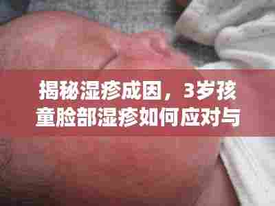 揭秘湿疹成因,3岁孩童脸部湿疹如何应对与预防?