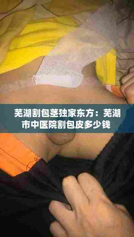芜湖割包茎独家东方:芜湖市中医院割包皮多少钱