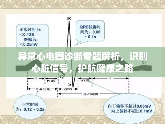 异常心电图诊断专题解析,识别心脏信号,护航健康之路