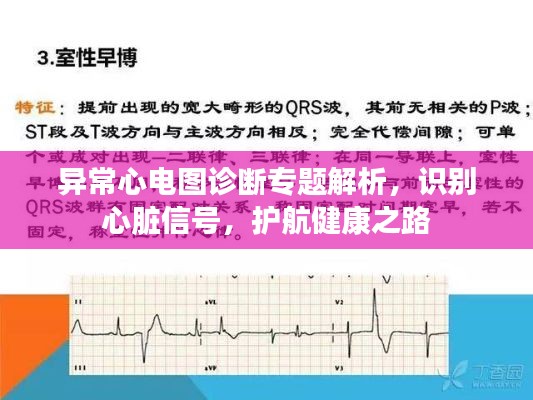 异常心电图诊断专题解析，识别心脏信号，护航健康之路