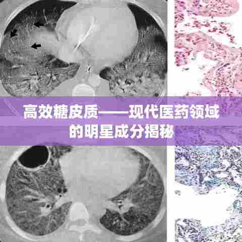 高效糖皮质——现代医药领域的明星成分揭秘