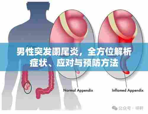 男性突发阑尾炎，全方位解析症状、应对与预防方法