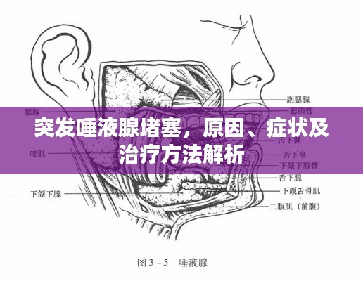 突发唾液腺堵塞,原因、症状及治疗方法解析